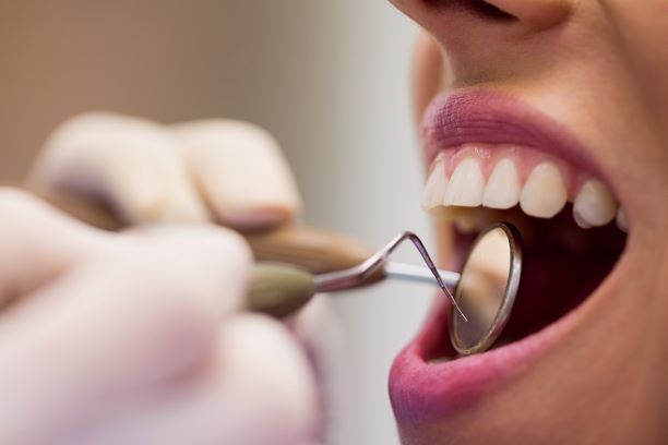 Imagem de uma boca aberta sendo examinada por um odontólogo